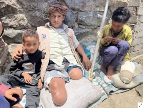 هيومن رايتس: ألغام الحوثيين تحصد الأرواح وتدمّر سبل العيش في اليمن