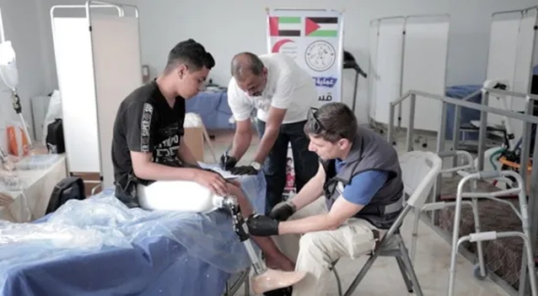 الإمارات.. المستشفى الميداني يبدأ تركيب الأطراف الصناعية للجرحى الفلسطينيين
